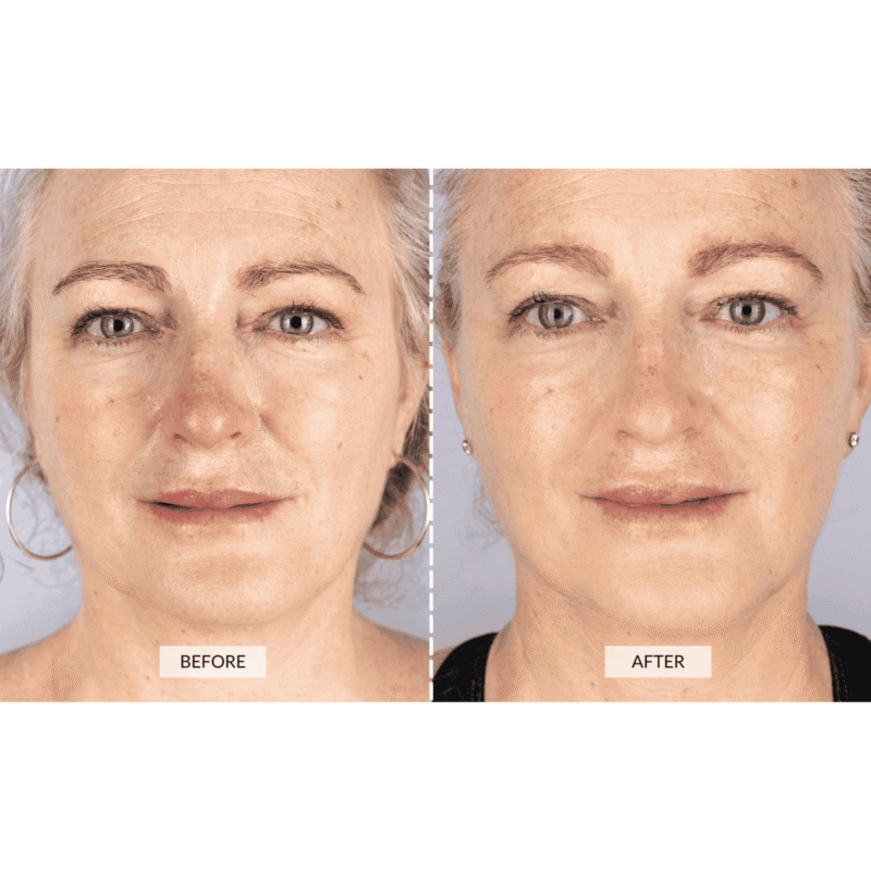 CurrentBody Skin LED Face & Neck Kit - Black Friday Offer - Image 3