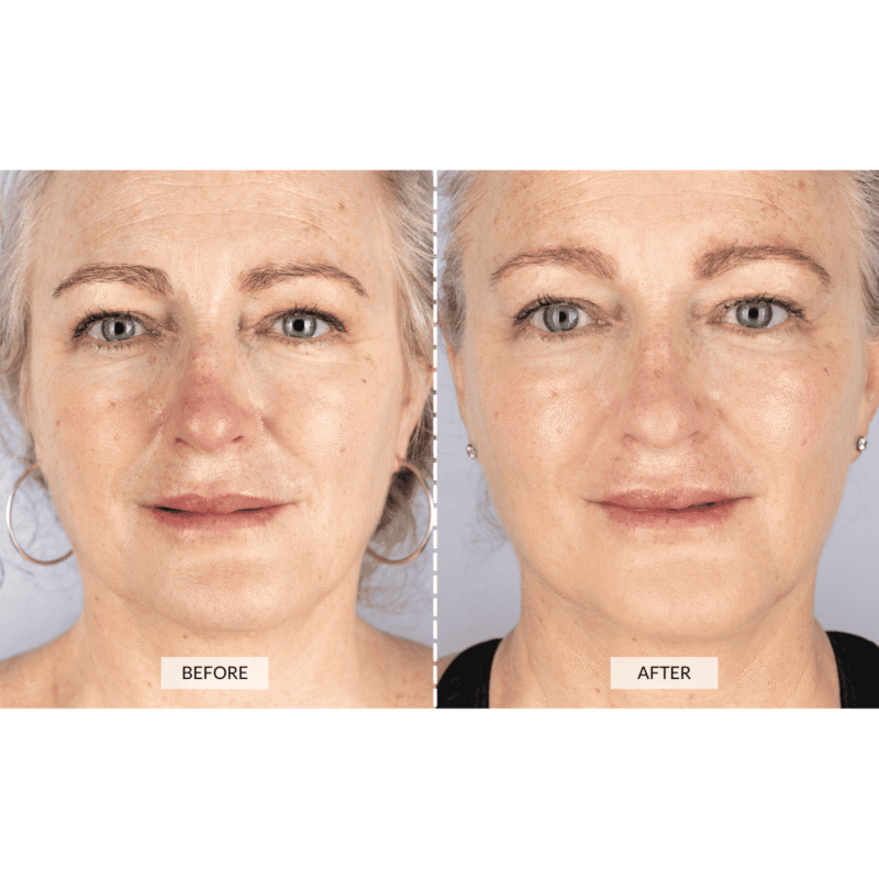 CurrentBody Skin – Silver Series 1 LED Mask Gift Set - Image 3