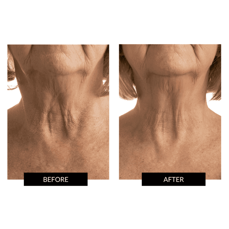 CurrentBody Skin LED Face & Neck Kit - Black Friday Offer - Image 7
