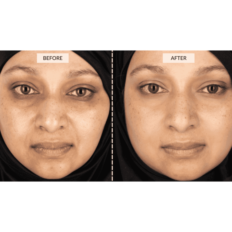 CurrentBody Skin LED Face & Neck Kit - Black Friday Offer - Image 4