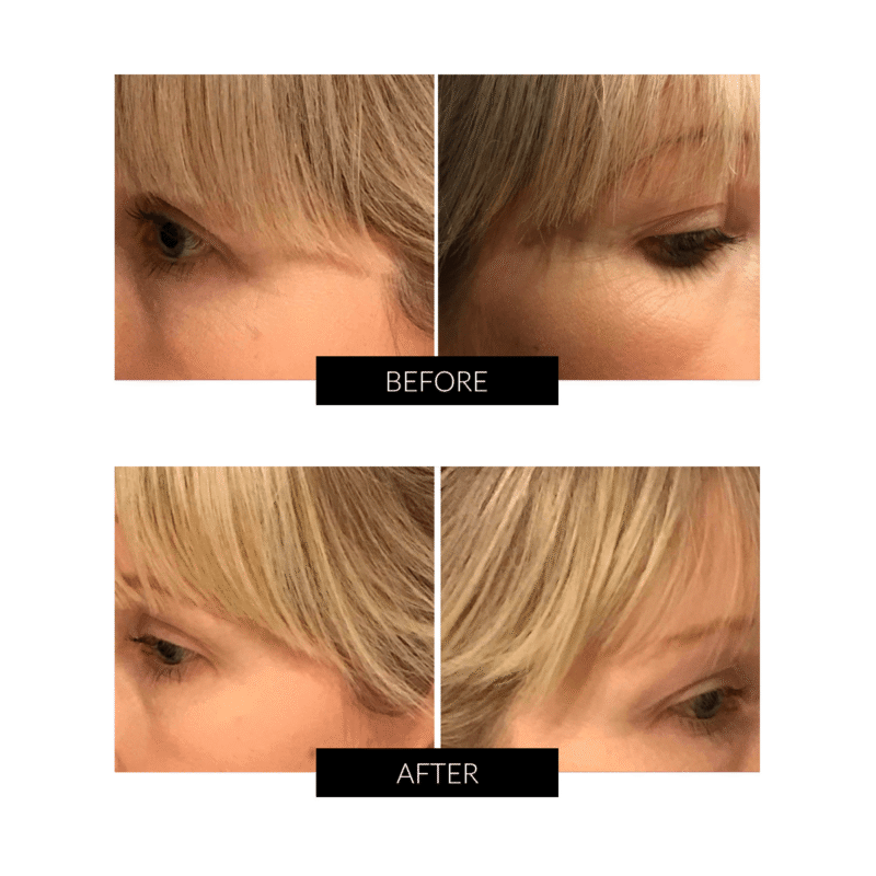 OXYjet GO Oxygen Facial System - Image 2