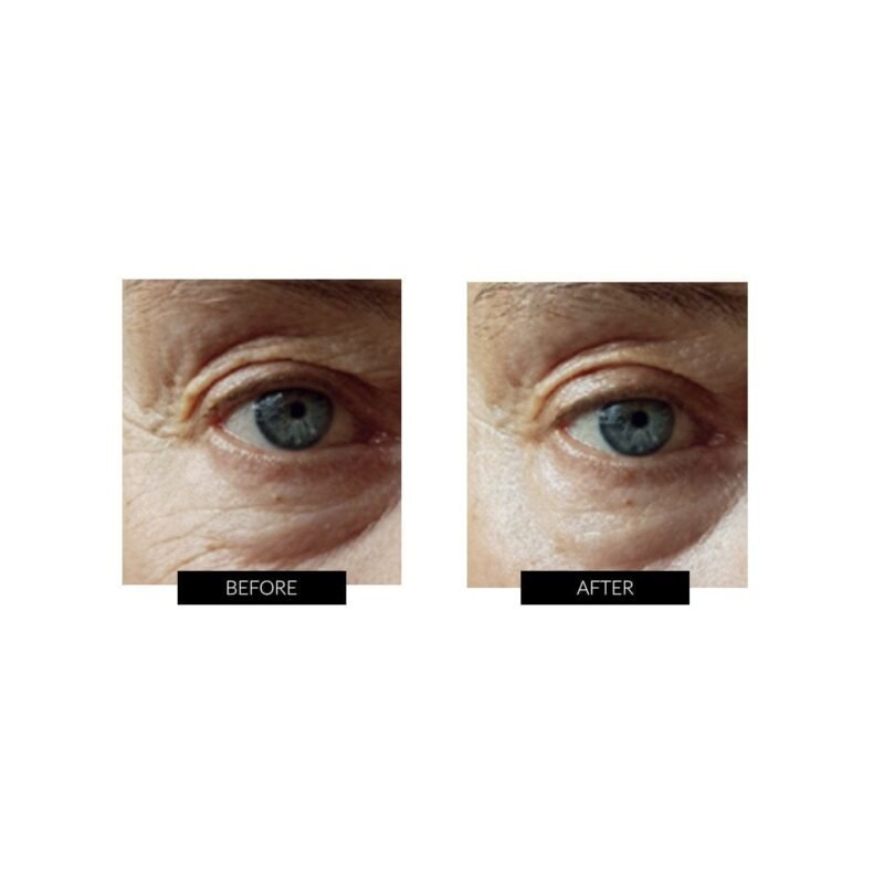 OXYjet GO Oxygen Facial System - Image 6