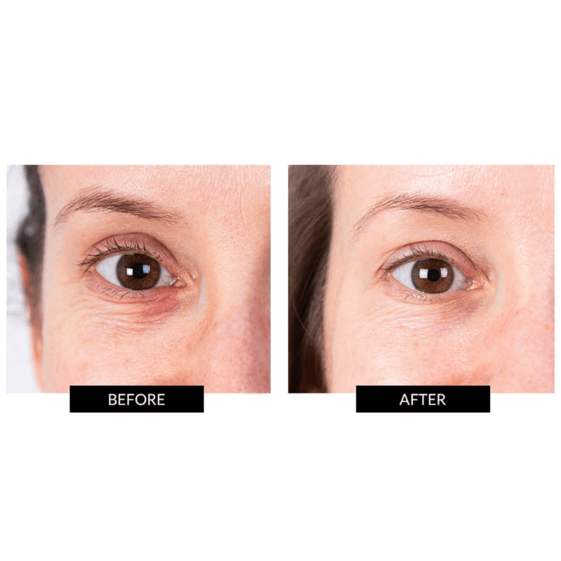 CurrentBody Skin LED Eye Perfector & 5 Eye Hydrogel Masks (worth £224) - Image 5