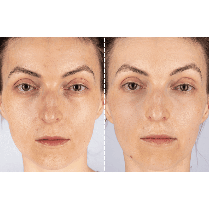 CurrentBody Skin X Peter Rabbit Limited Edition LED Light Therapy Mask - Image 4